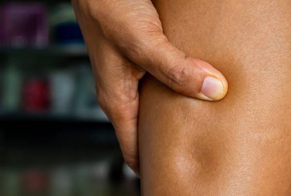 Membranous glomerulonephritis