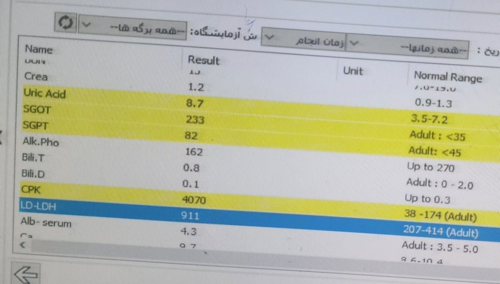 رابدومیولیز