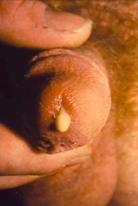 گنوره